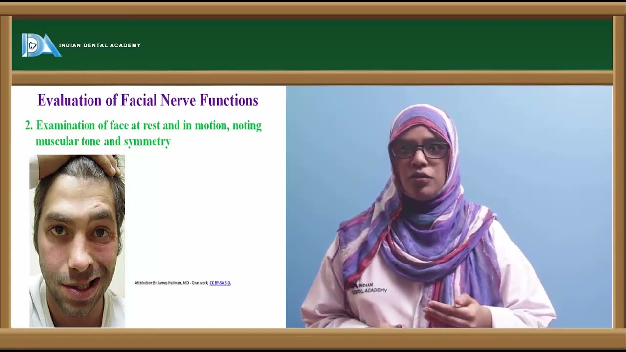 Лицевой нерв | Челюстно-лицевая хирургия | #NEET#MDS#BDS#NBDE#ORE#DDS