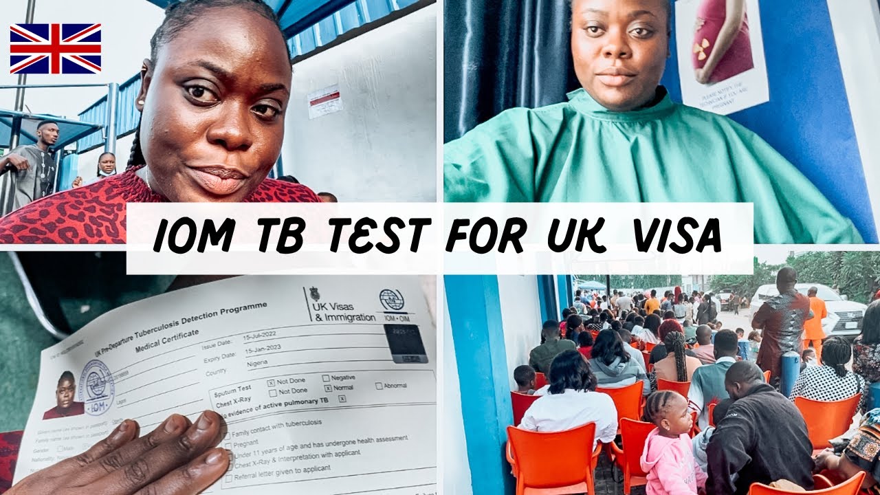 My IOM Tuberculosis Test Experience for UK 🇬🇧 Student Visa: Step by Step process