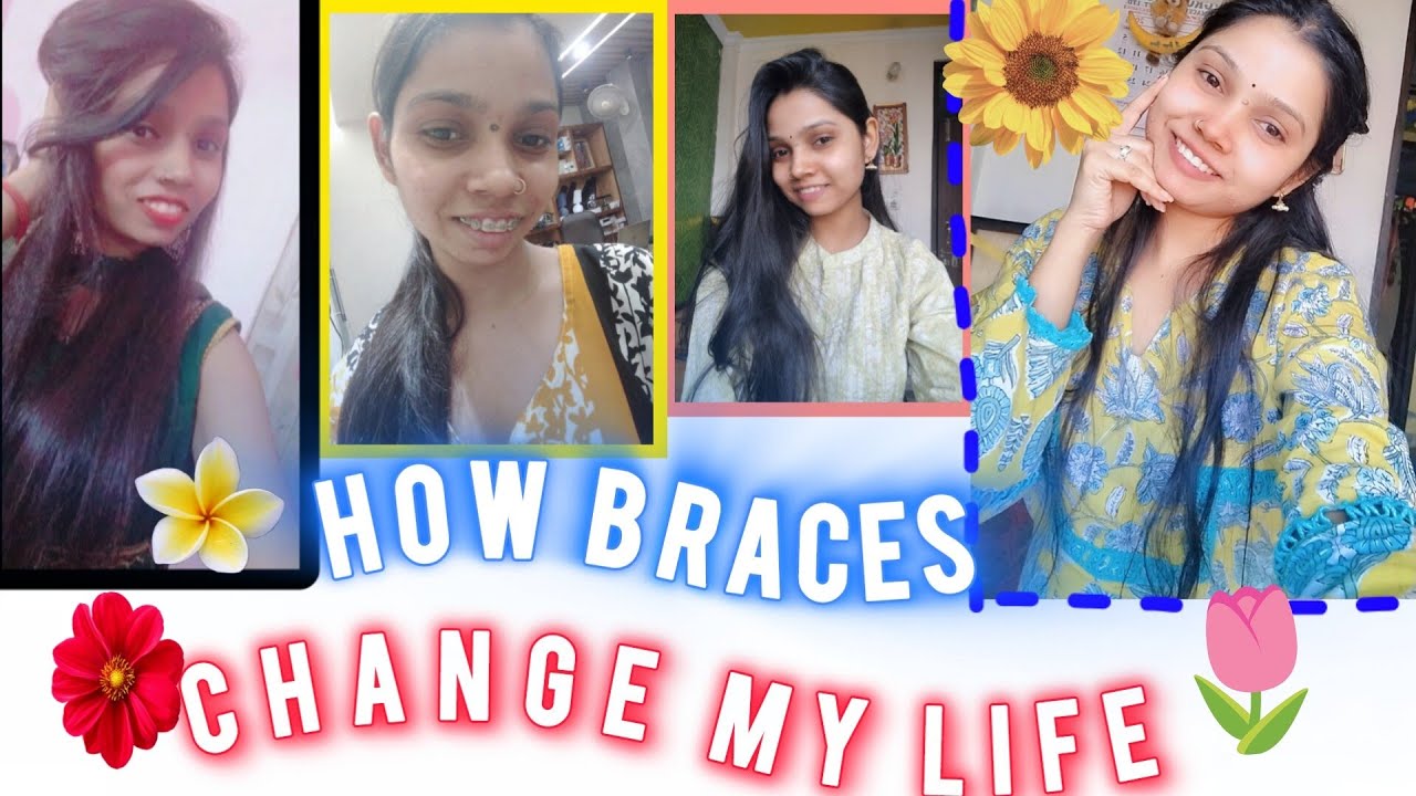 |how Braces change🌷😁my life|my braces journey |my braces experience|braces treatment braceslifestyle