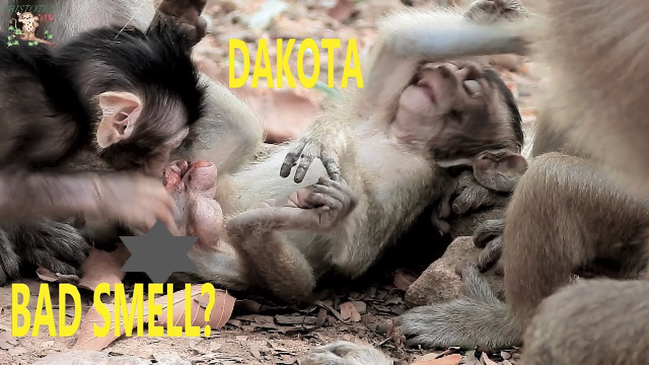 BIG WOUND OF BABY DAKOTA MAKE BAD SMELL? , POOR BABY QUINTON WANT TOUCH WHILE BABY DOKOTA SICKNESS |