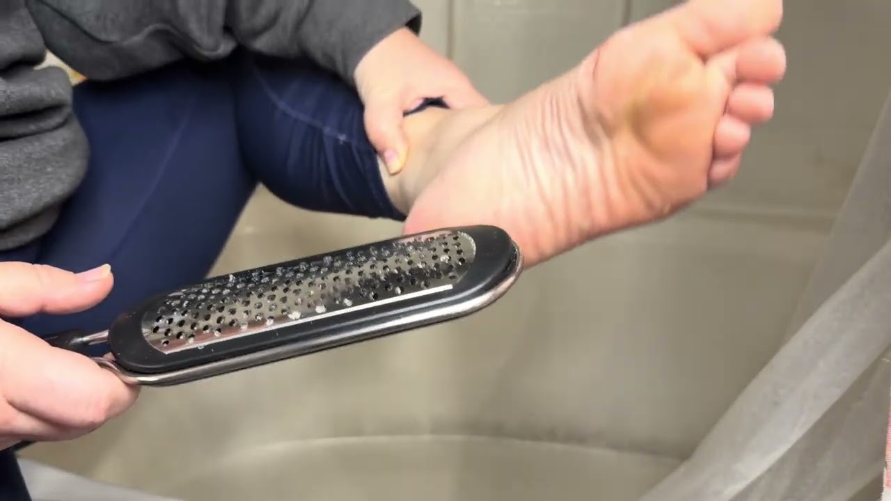 2-in-1 Foot File; Stainless Steel Professional Pedicure Tool for Hard Cracked Dead Heel Skin