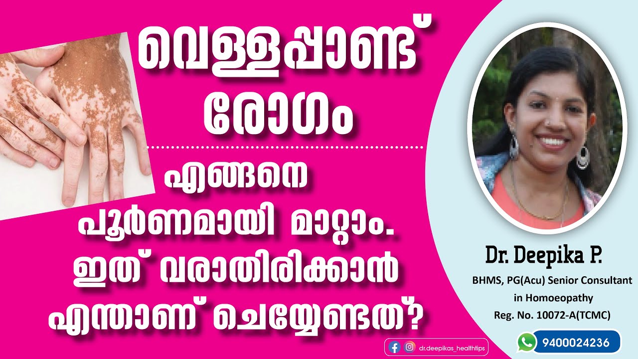 എന്താണ് വെള്ളപ്പാണ്ട് രോഗം | ഇത് ആർക്കൊക്കെ വരാം | വരാതിരിക്കാൻ ശ്രദ്ധിക്കേണ്ട കാര്യങ്ങൾ എന്തെല്ലാം
