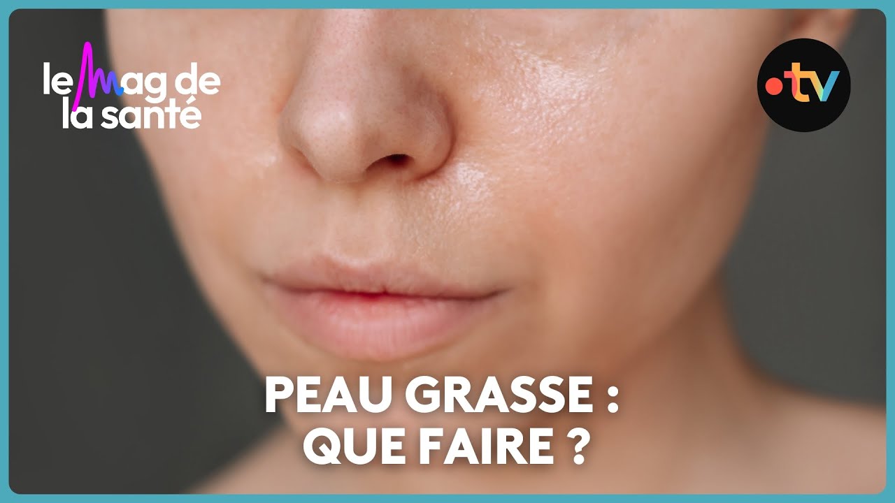 3 r&egrave;gles pour bien prendre soin de sa peau grasse