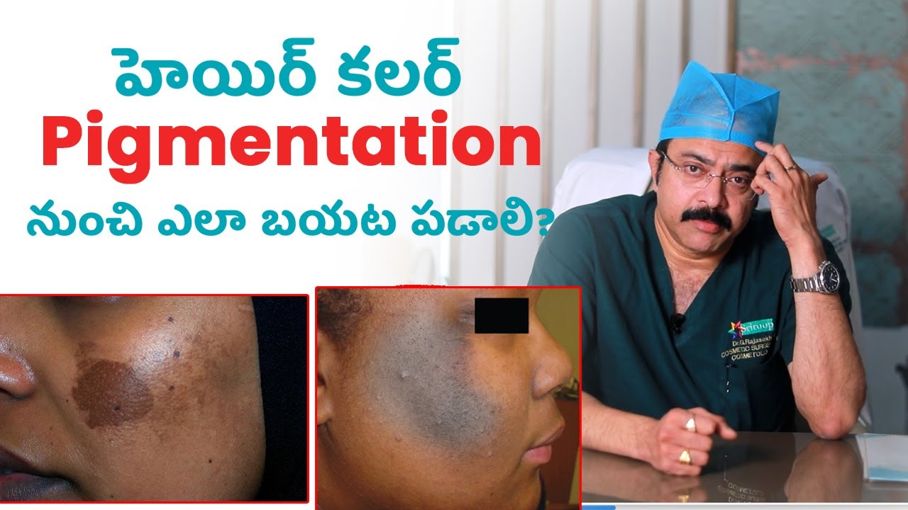 Hair Color Pigmentation Remedies & Solution | Deep Pigmentation | Face & Neck | Treatment | Cosmetic
