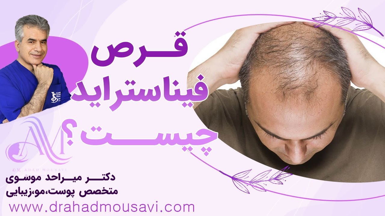 قرص فیناستراید مزایا و معایب آن از صفر تا صد | تأثیرات  فیناستراید بر ریزش مو