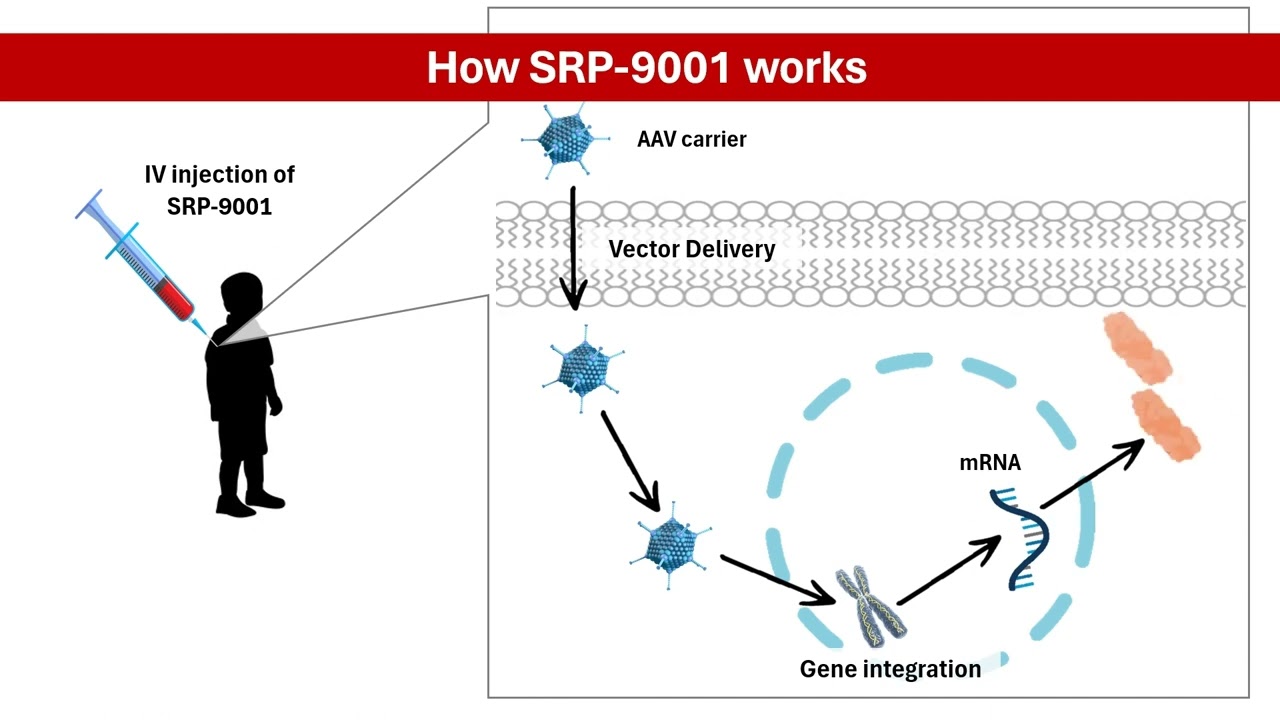Duchenne Muscular Dystrophy: Could Gene Therapy Be the Answer? Exploring SRP-9001