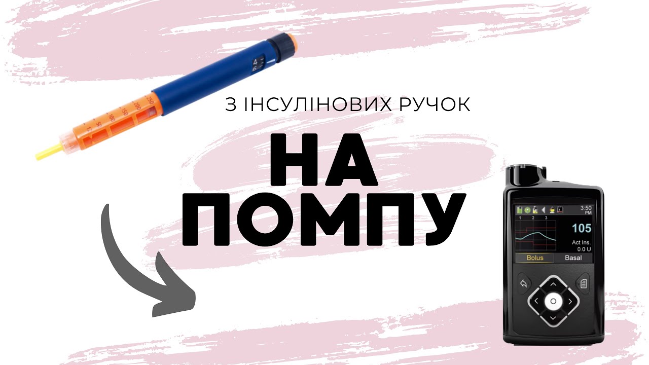Перехід з шприц-ручок на інсулінову помпу. Усе, що треба знати