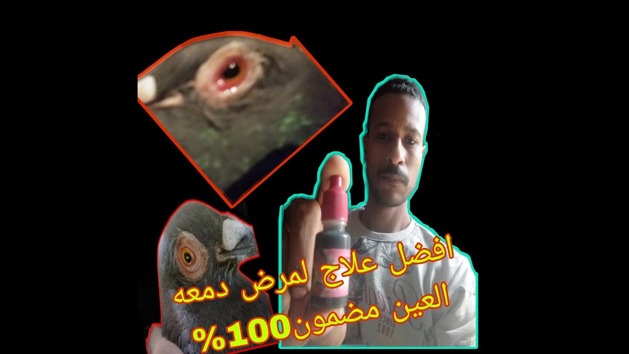 افضل علاج لدمعة العين الجزء الاول