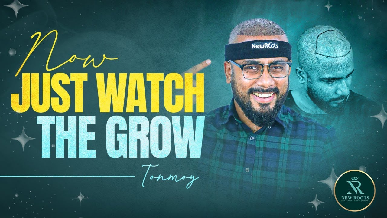 Style Hut Tonmoy Hair Transplant: His Surgery Experience at New Roots 😀 | Bangladesh
