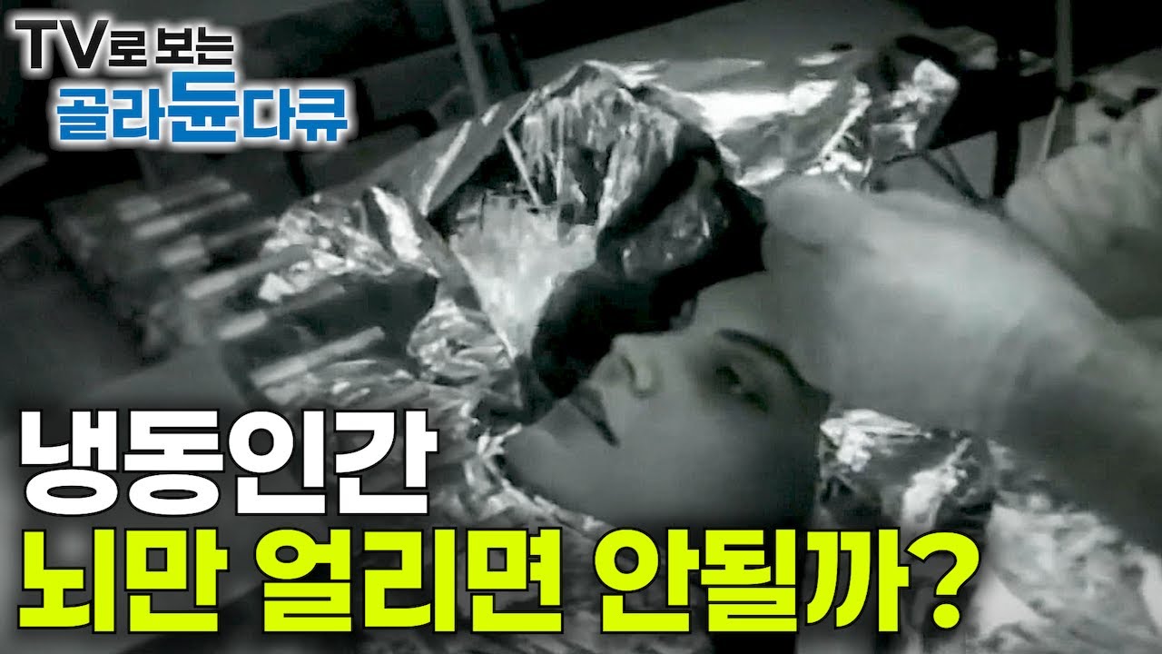 꼭 몸 전체를 얼려야 할까? 얼리긴 얼렸는데.. 냉동인간 깨어날 수 있을까?｜냉동인간 뇌만 얼리면 생기는 일｜진시황의 꿈꾸던 영원한 불멸의 삶｜과학 다규 비욘드｜#골라듄다큐