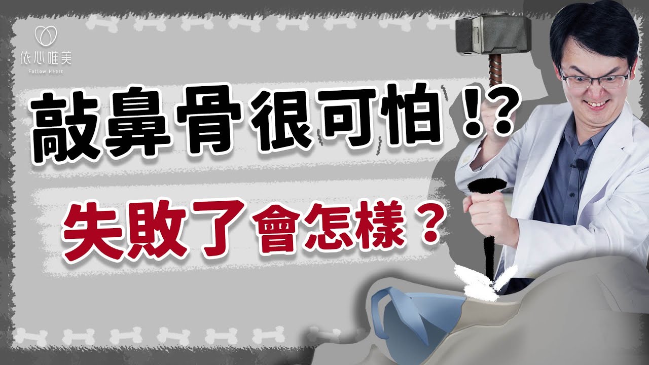 敲鼻骨很可怕？隆鼻合併敲鼻骨是否有後遺症 ｜依心唯美 謝東穎醫師