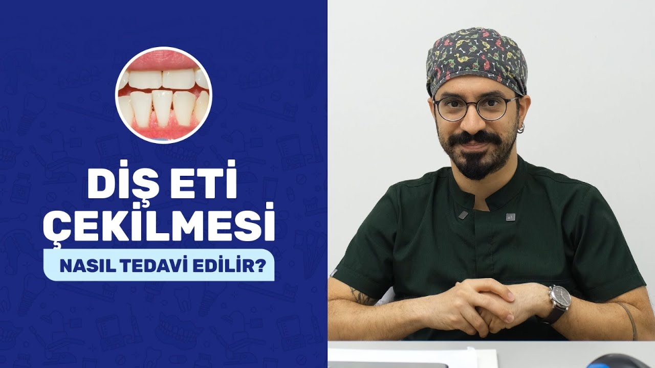 Diş Eti Çekilmesi Nasıl Tedavi Edilir?