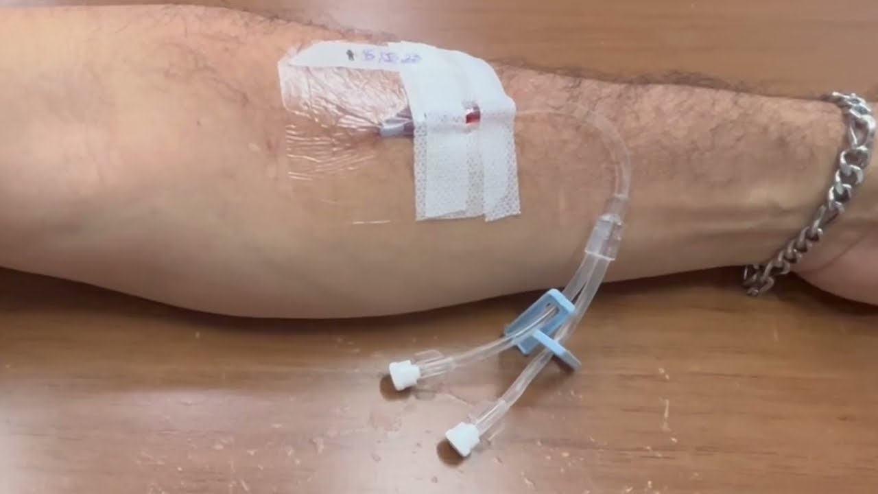Punção Venosa