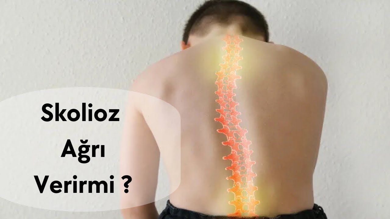 SKOLİOZ AĞRI VERİRMİ? | UZMAN FİZİOTERAPEVT AZİZ DAVRİSHOV