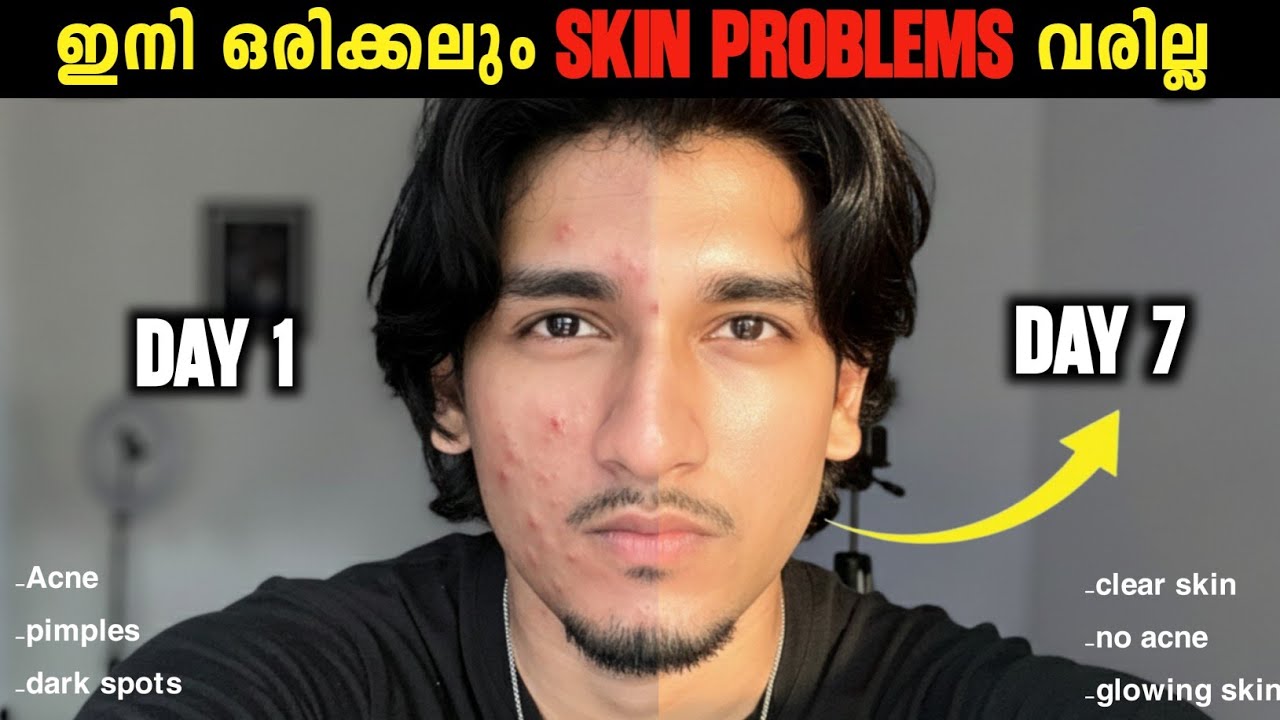 3 Step Skincare Routine For Clear & Glowing Skin 🧏 💯
