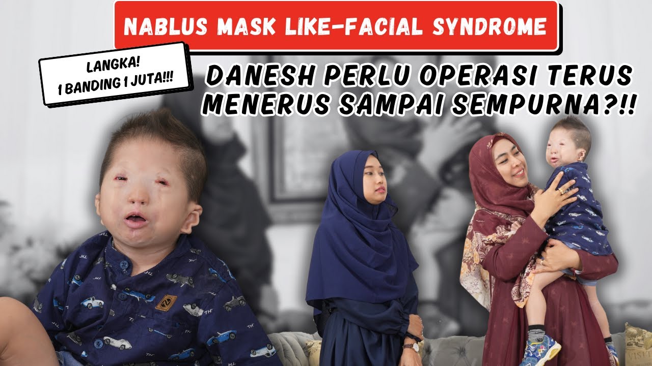 EPS 34 | UMUR 3 TAHUN DANESH LAKUKAN 10 OPERASI!!! | NMLFS | #PEJUANGNICU