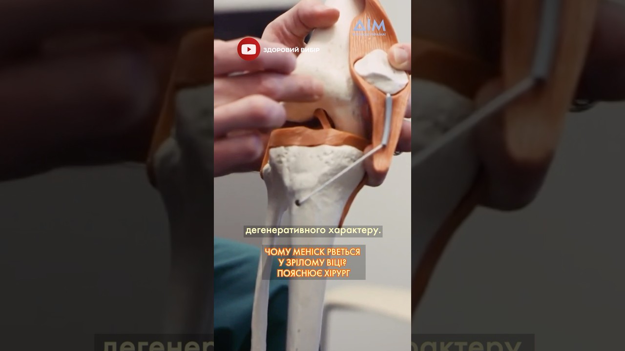 🧐 Чому меніск рветься у зрілому віці? Пояснює хірург В'ячеслав Карась у програмі 