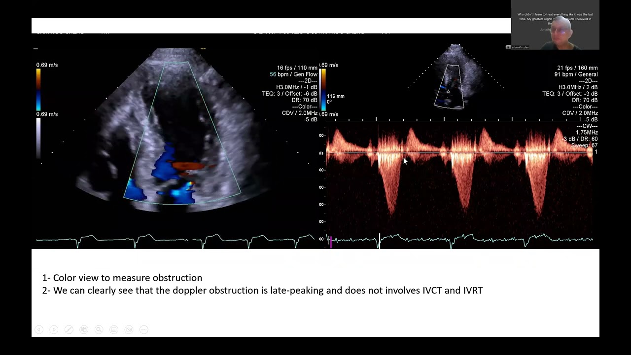 Interesting echo cases 1