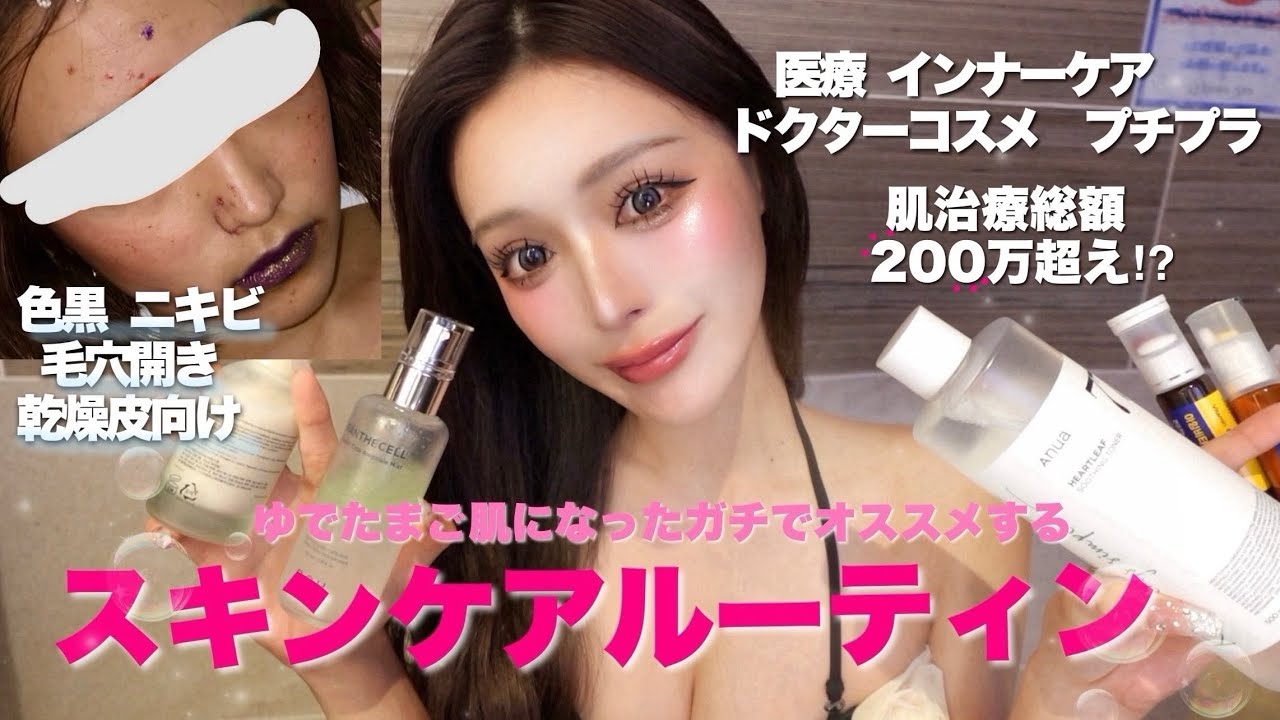 【NO案件】色黒ボコボコ肌から200万かけて透明感溢れる毛穴0の陶器肌になりました。
