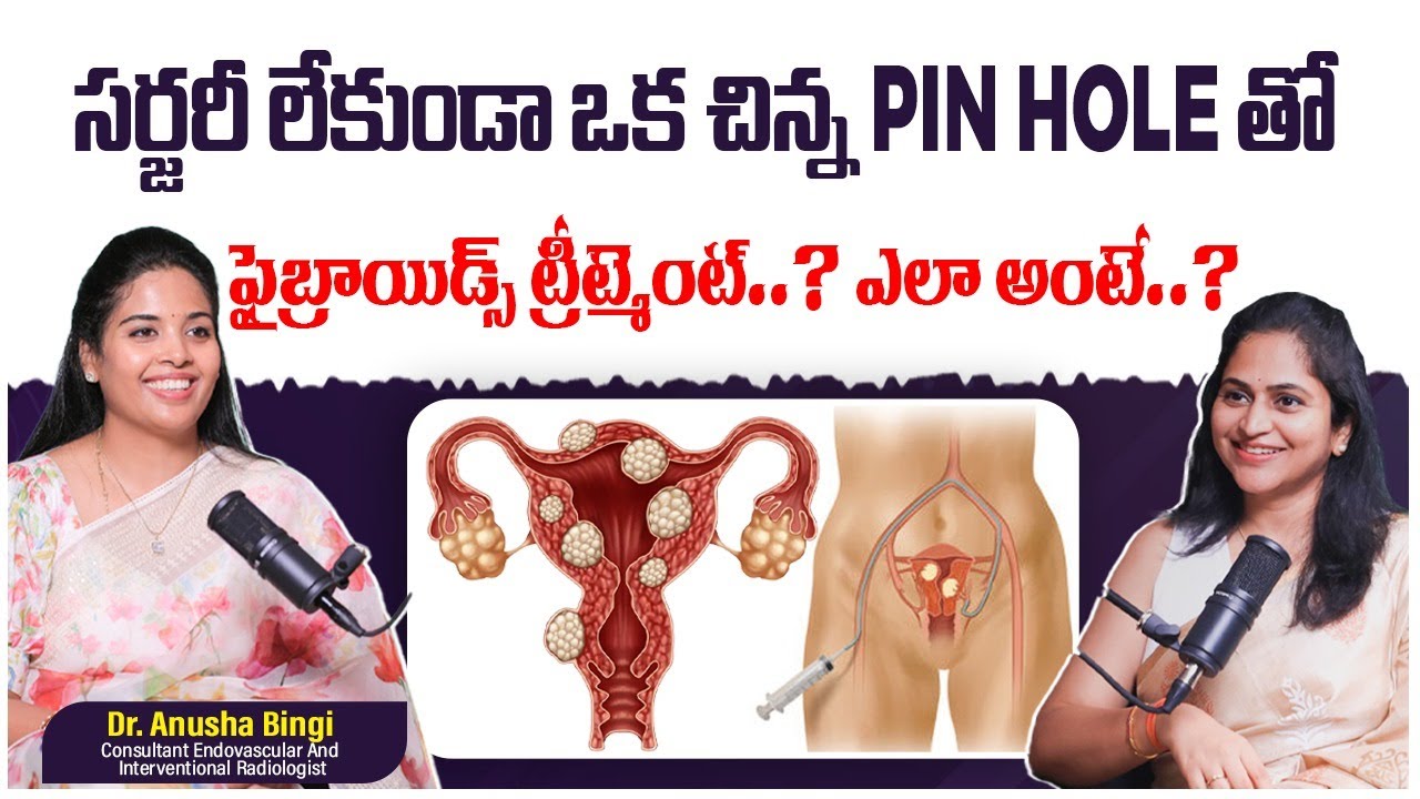 What is UFE Treatment? Best Non-Surgical Option for Fibroids |UFE Procedure Step by Step | Dr Anusha