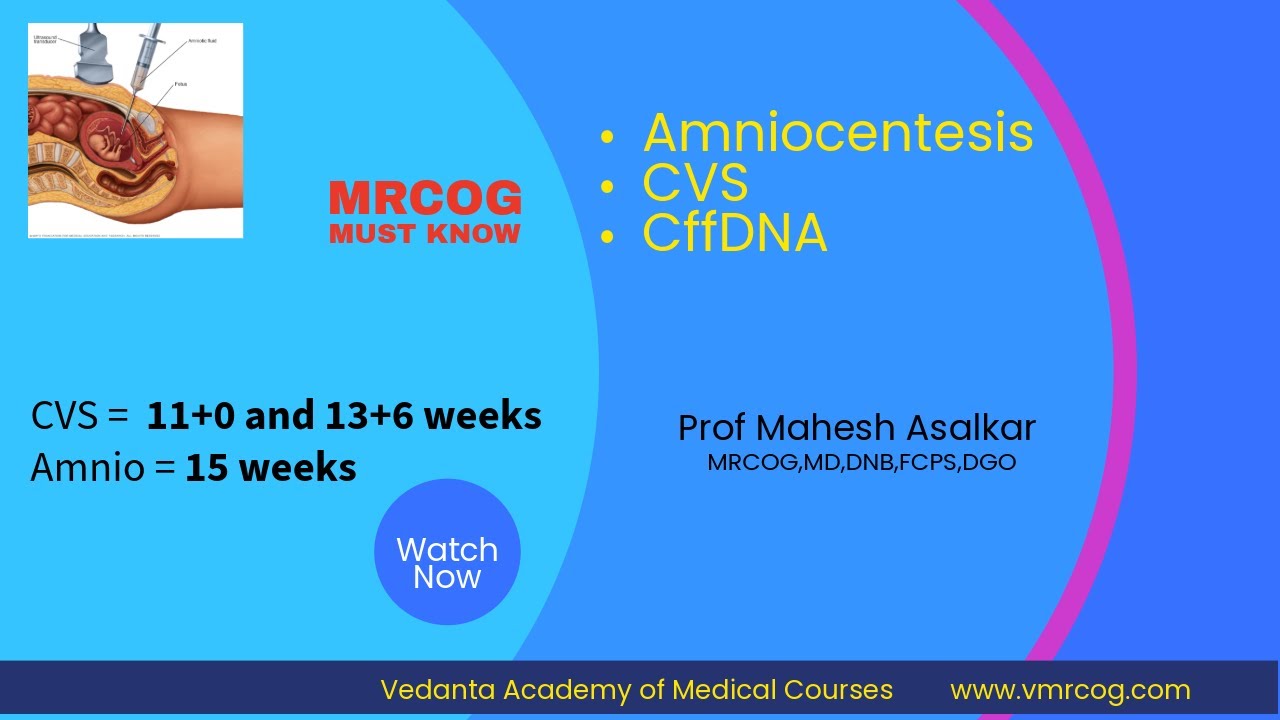 Amniocentesis vs CVS vs cfDNA | RCOG Green-top & TOG | MRCOG Part 2