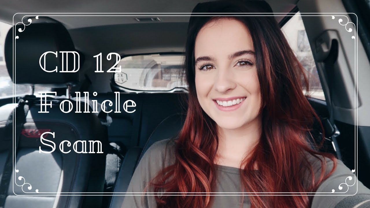 CD 12 FOLLICLE SCAN & LIFE UPDATE | Brooke & Jay