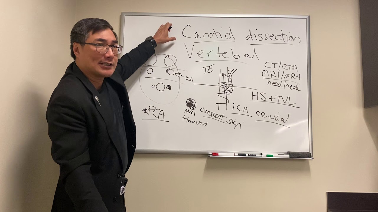 Arterial dissections in Neuro Ophthalmology