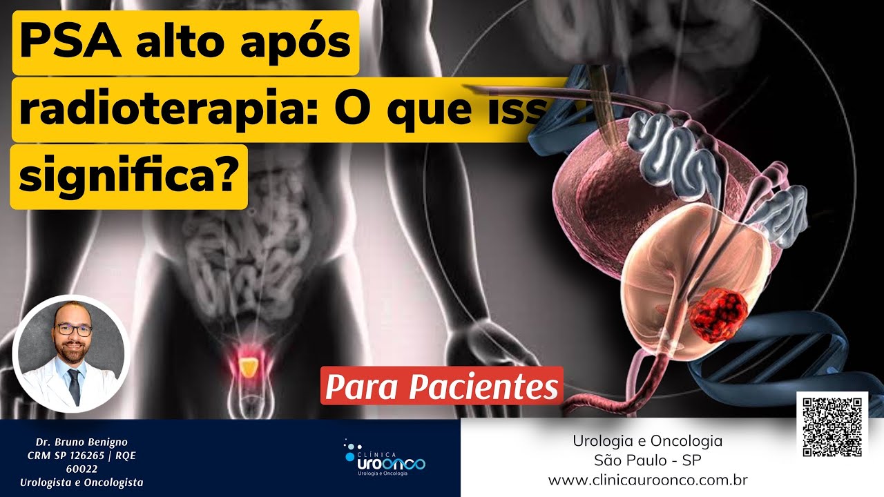 PSA alto após radioterapia: o câncer de próstata pode ter voltado? Urologista explica
