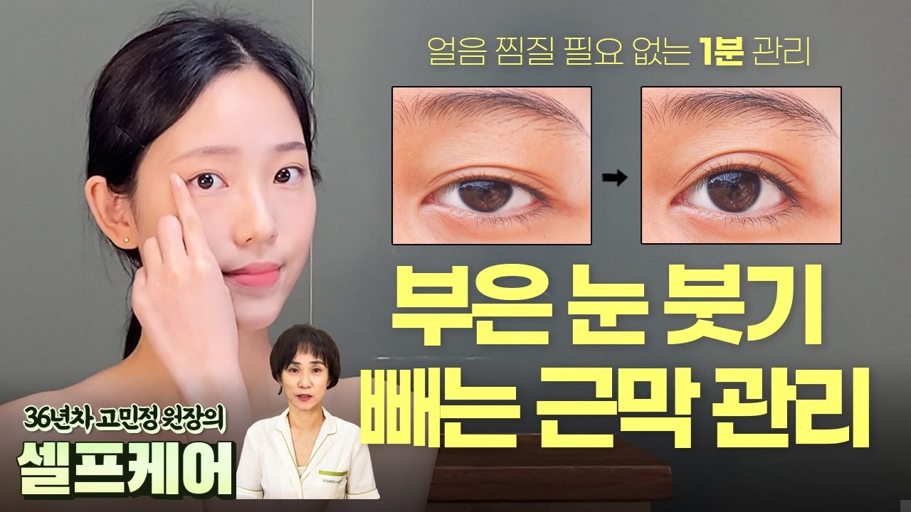 퉁퉁부은 눈 붓기 빼고  또렷한 눈매 만들기