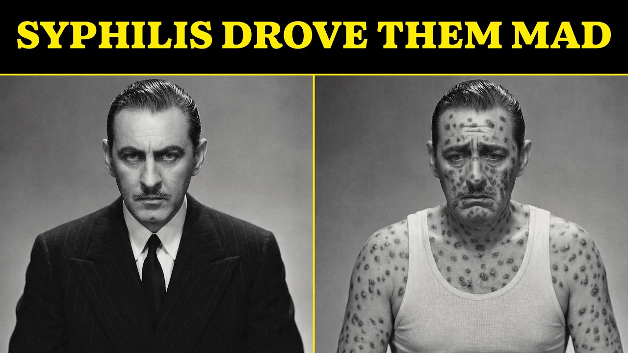 10 Classic Hollywood Legends Who Went Insane from Untreated Syphilis