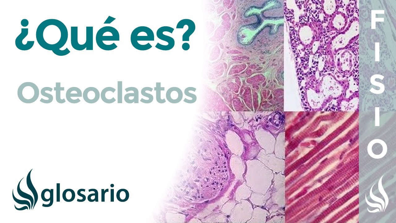 OSTEOCLASTOS | Qu&eacute; son, significado, ubicaci&oacute;n, c&oacute;mo se forman, y cu&aacute;l es su funci&oacute;n