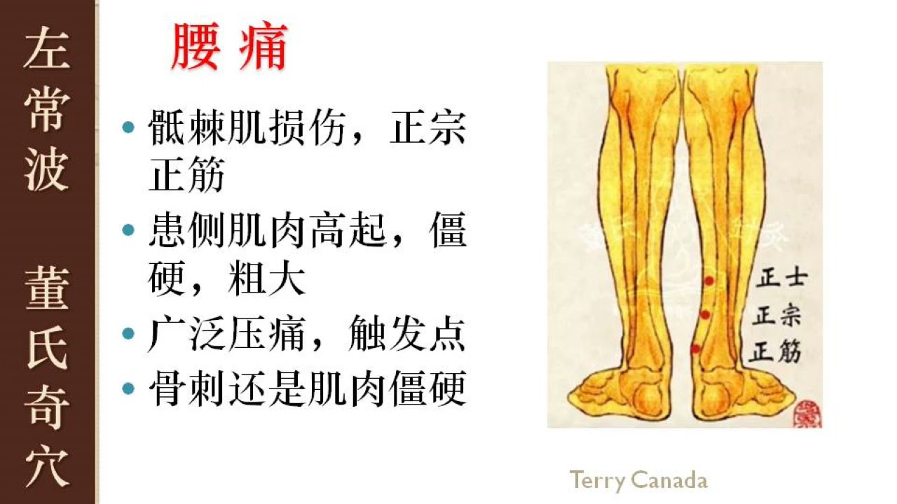 7.1  腰痛 | 左常波 董氏针灸 刺血 解结  | Master Tung Acupuncture Points