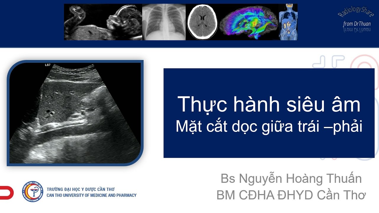 Hướng dẫn thực hành MCCB -2021- MC dọc cận giữa trái và phải