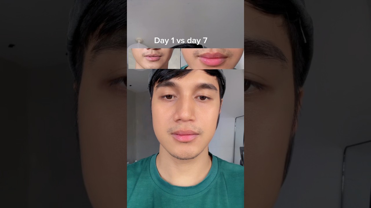 7 days with skintific lip serum 👄 #SKINTIFIC #SkintificPH #skintificlipserum #lipserum