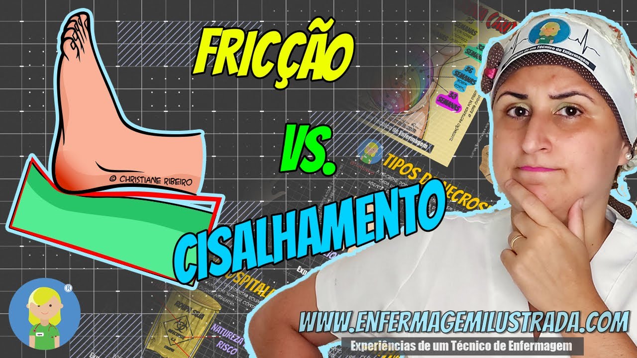 Fric&ccedil;&atilde;o e Cisalhamento: Como identificar!