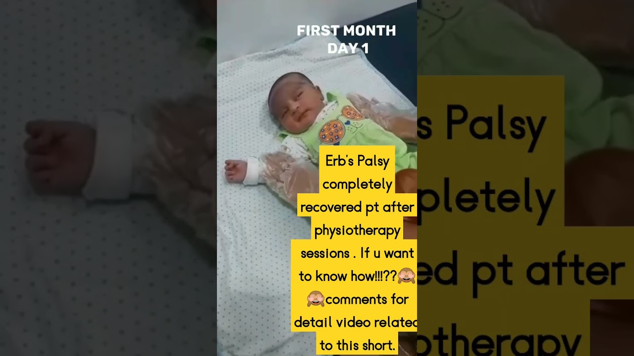 Erb's palsy treatment through physiotherapy # doctor physio