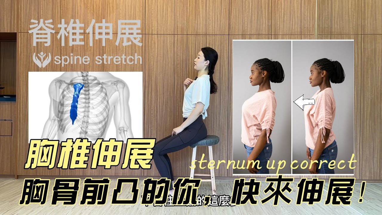胸骨前凸、背部過直矯正運動：「坐姿脊椎伸展spine stretch」。只需20秒伸展，上班坐著就可以矯正錯誤的挺胸姿勢，造成胸骨前凸、背部痠痛、膏肓部位緊繃。