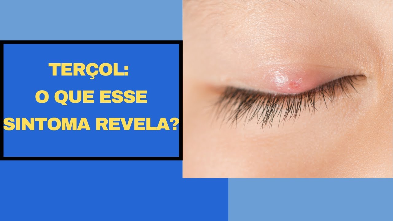 TERÇOL O QUE ESSE SINTOMA REVELA