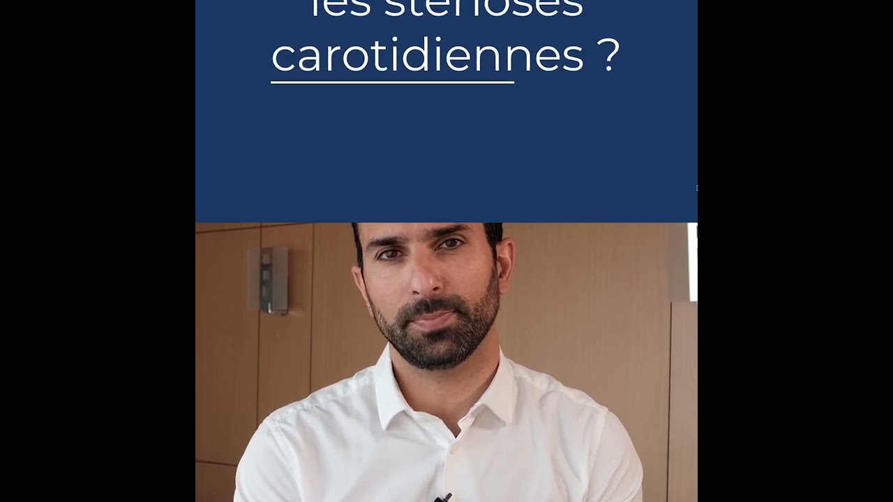 AVC et carotides .