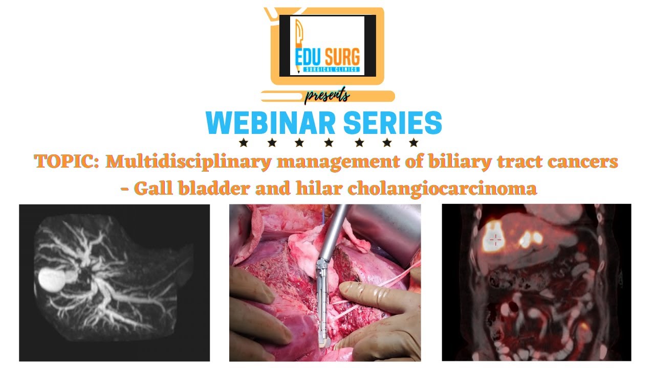Zoom webinar - gall bladder cancer - hilar cholangiocarcinoma - Multidisciplinary cancer management