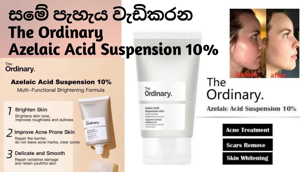 Azelaic Acid Suspension 10% Review | The Ordinary සම පැහැපත් කරන නිශ්පාදන #azelaicacid