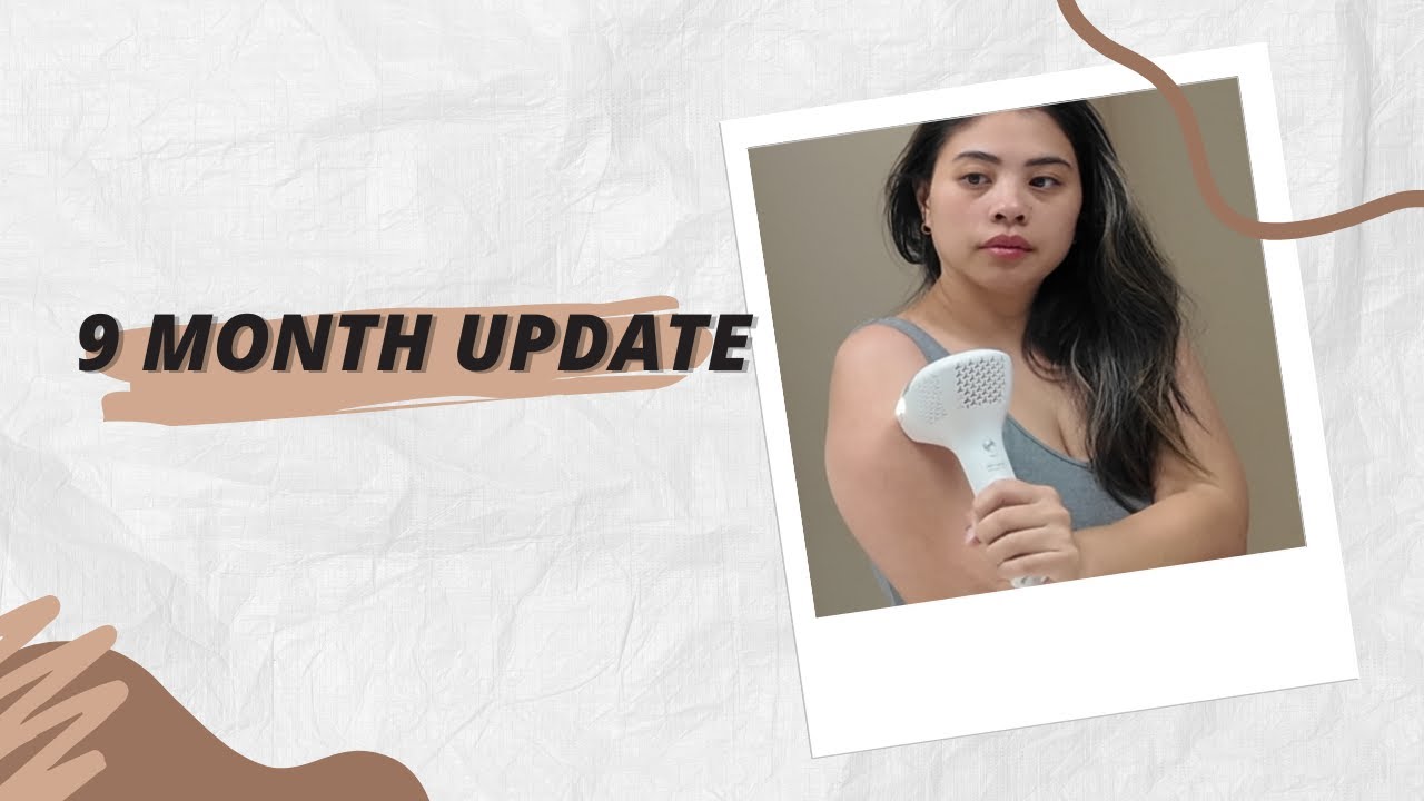 9 Months Update: DermRays V8S Laser Hair Removal Review: Insights and Outcomes, Science & Comparison