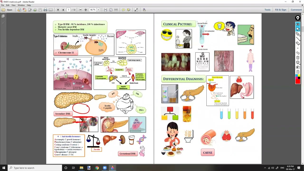 5- Hypertension & Pulmonary Embolism شرح باطنة دكتور سويلم