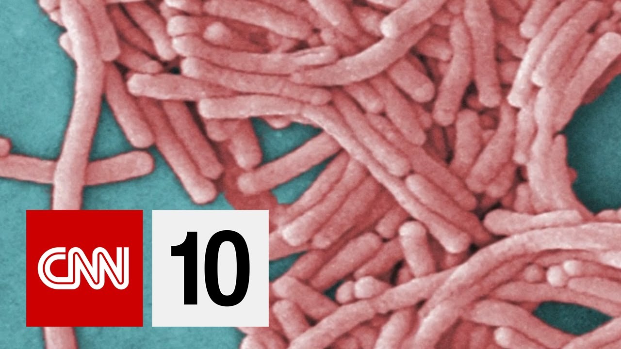 What is Legionnaires' disease?