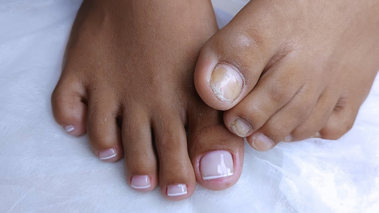 PEDICURE COM ESMALTAÇÃO EM GEL: ATENDIMENTO