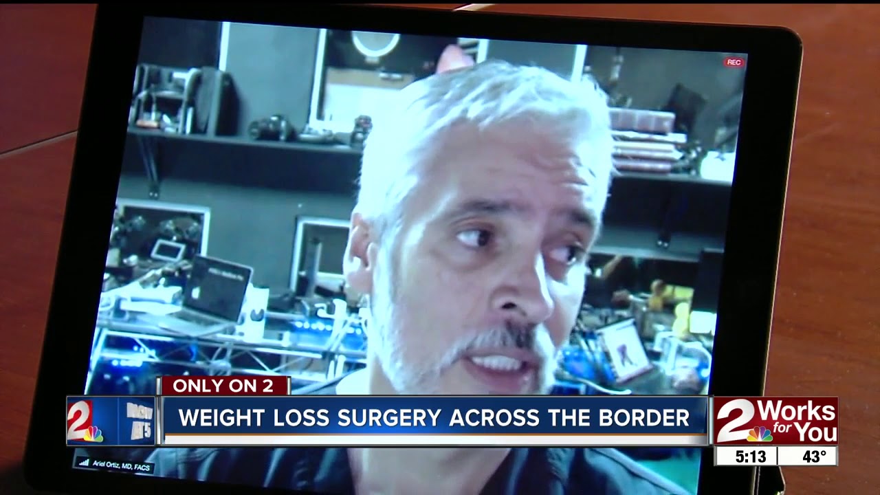Weight Loss Surgery Across the Border: Bariatric Procedure in Mexico