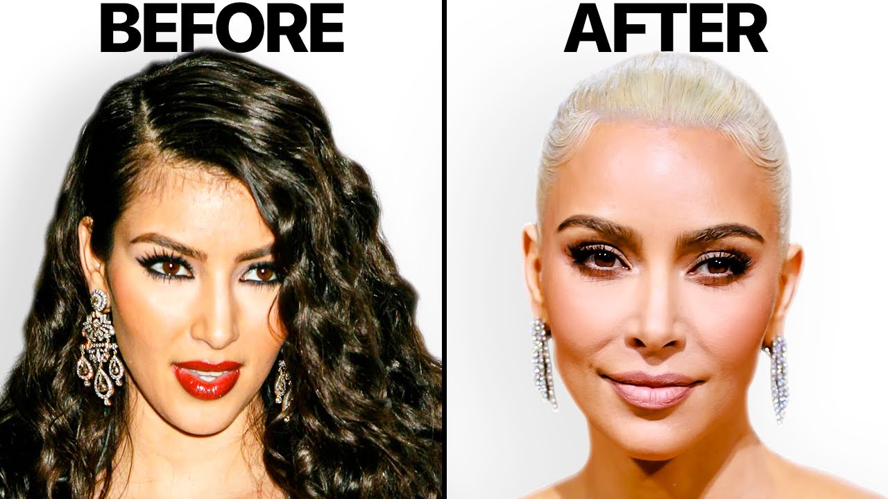 What Happened to Kim Kardashian's Face? | Plastic Surgery Analysis