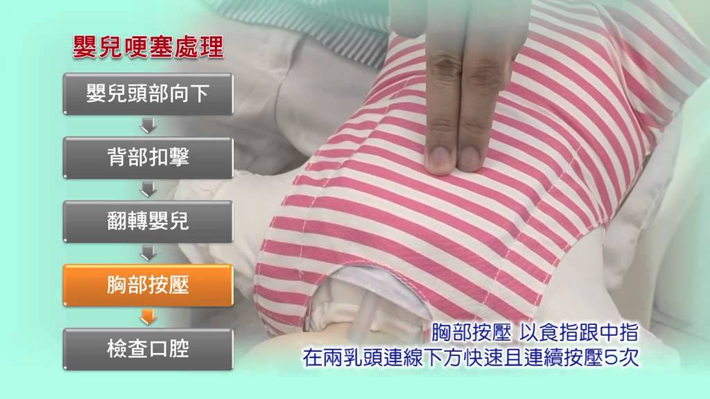 小兒哈姆立克