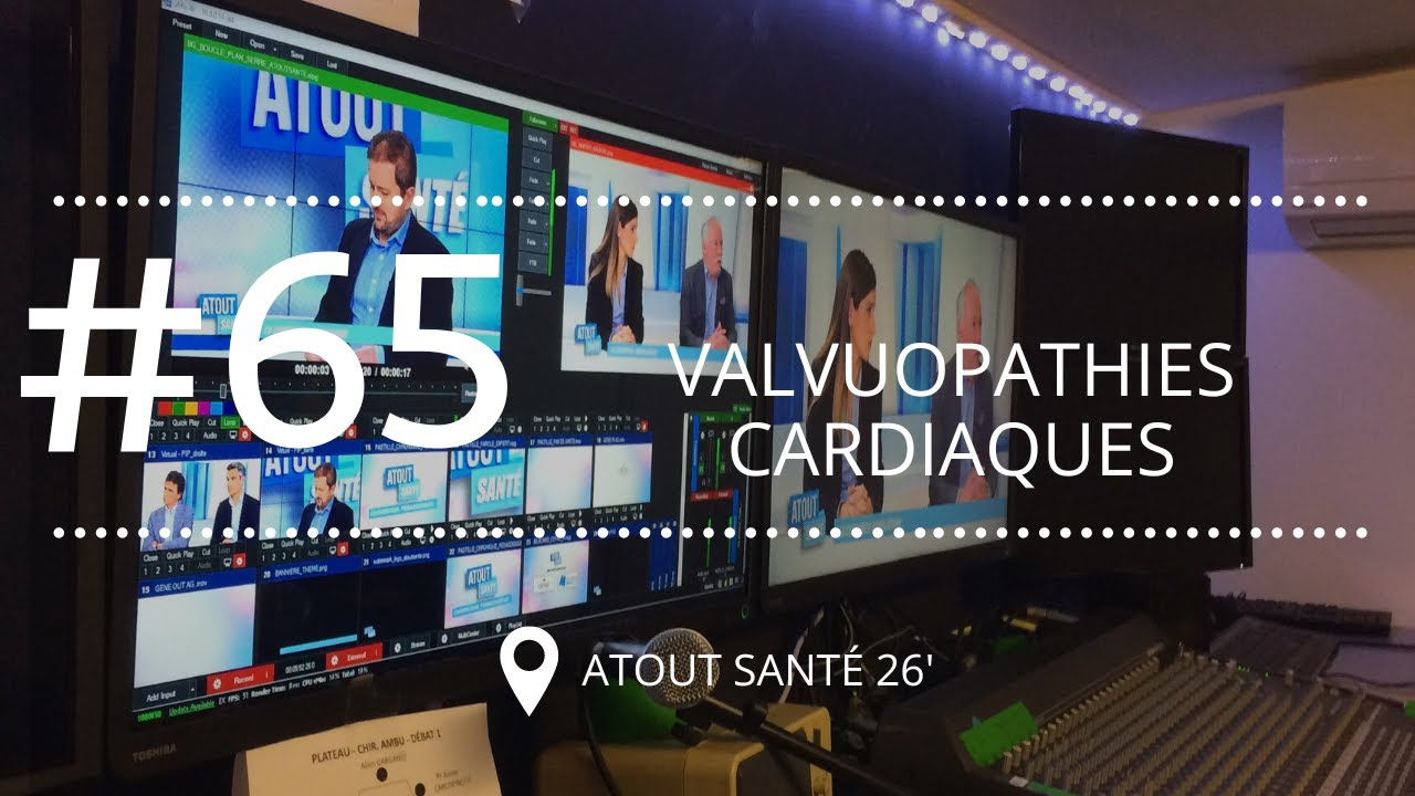 [ATOUT SANTE #65] Le traitement des valvulopathies cardiaques