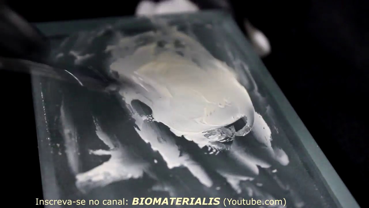 Cimento de Fosfato de Zinco Cimentação